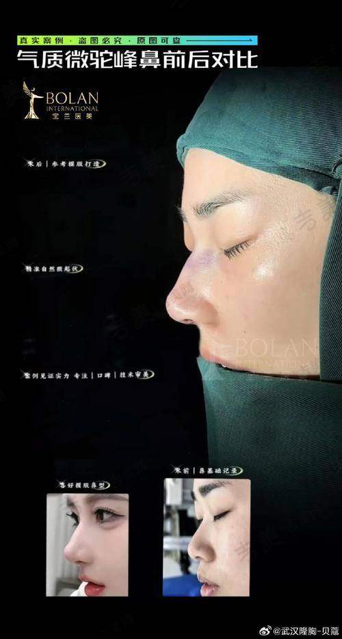 杭州星容妍医疗美容门诊口碑好不好
