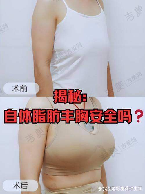 况佳丽医生口碑好不好