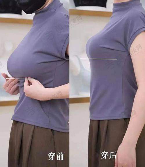 尹剑医生手术费用