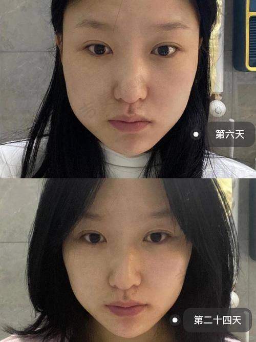 赵在勋医生真实评价