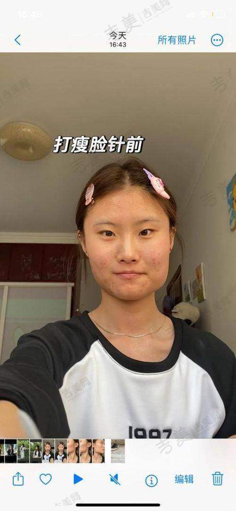 尹剑医生做完手术的感觉