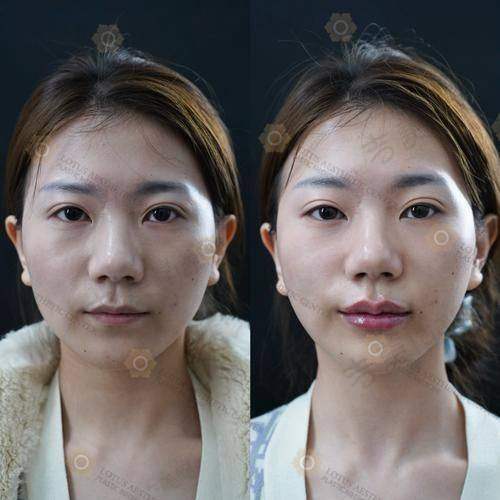 杭州星容妍医疗美容门诊医生简介