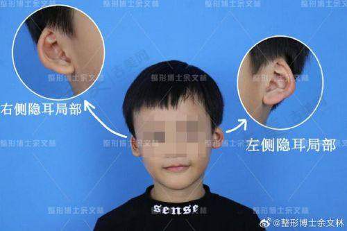 贵阳云岩容妍医疗美容门诊部顾客实例