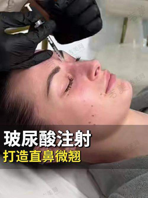 张娟娟医生怎么挂号预约