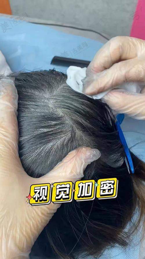 杭州星容妍医疗美容门诊医生情况