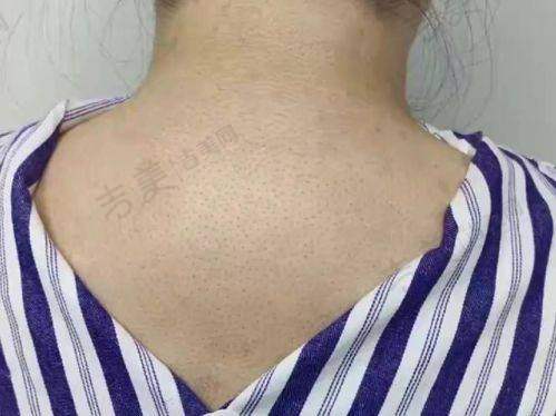 宝鸡爱容妍医疗整形美容医院怎么样，口碑评价如何？