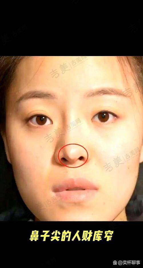 柴云医生手术价格如何