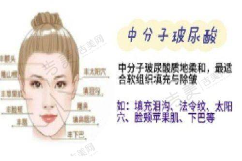 四川华 西拉皮手术一般大概多少钱?不同情况的价格示例