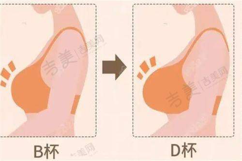 赖炳文医生怎么挂号