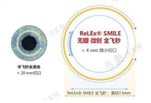 成都新视界眼科医院是正规医院吗?规范管理确保医疗质量