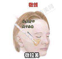 四川华 西拉皮手术一般大概多少钱?拉皮相关项目价格