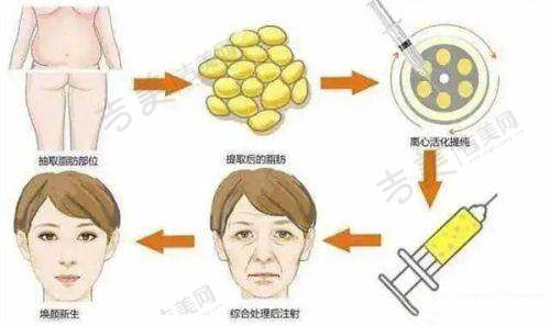 二、阜阳纳美星范医疗美容门诊部擅长项目