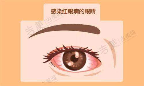 五、医院如何审核潍坊白内障手术免费政策申请?