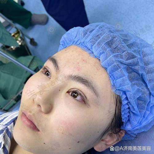 宁波海曙星范柠栎医疗美容门诊部卢国庆做手术价格