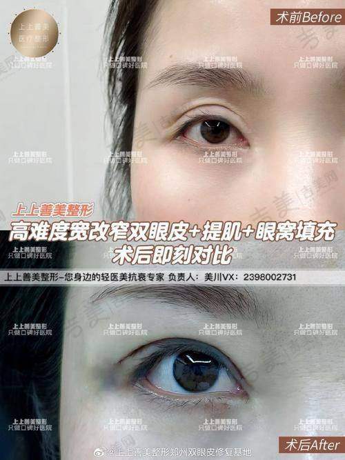 张翰理医生做手术价格