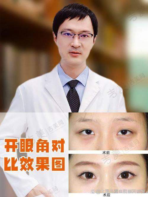 陈德裕医生怎么挂号