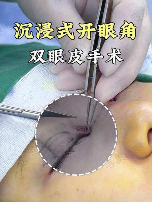 张简仕煌怎么挂号
