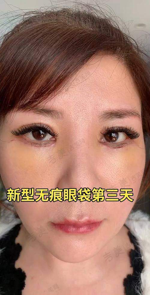 谭改运医生口碑如何