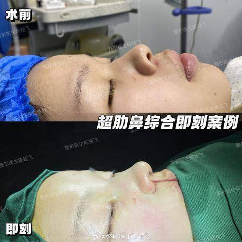 金鑫医生做手术价格情况