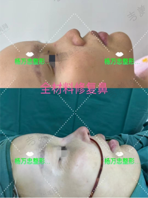 七、哈尔滨星范医疗美容门诊部顾客实例情况