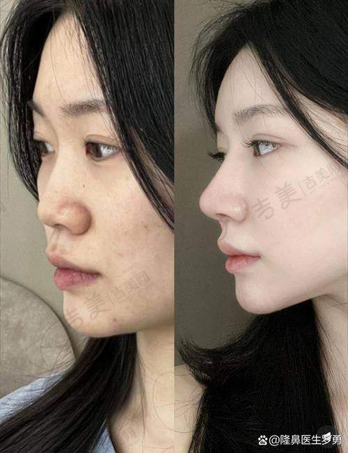 刘刚医生的任职经历和荣誉与成就