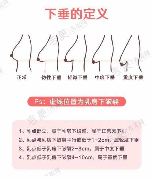曲胜医生顾客实例图片