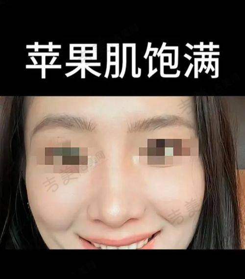 梁青松医生做手术价格