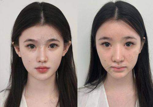 成都星范医疗美容整形医院价格表