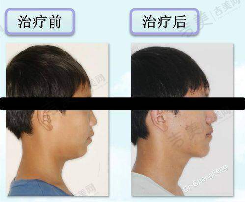 刘传仁口碑如何