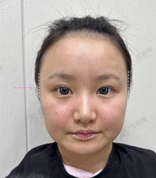 七、唐山星范医疗美容医院口碑好不好？附真实患者口碑评价