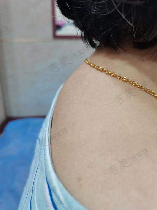 宁波星范医疗美容医院口碑好不好?附真实患者口碑评价