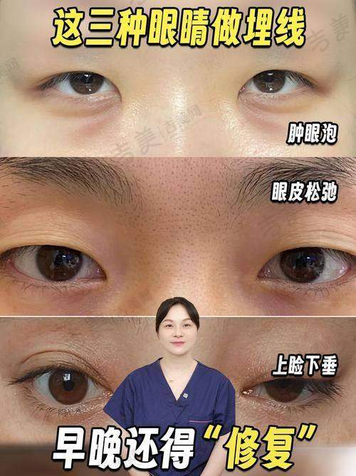 四、朱敏医生口碑如何