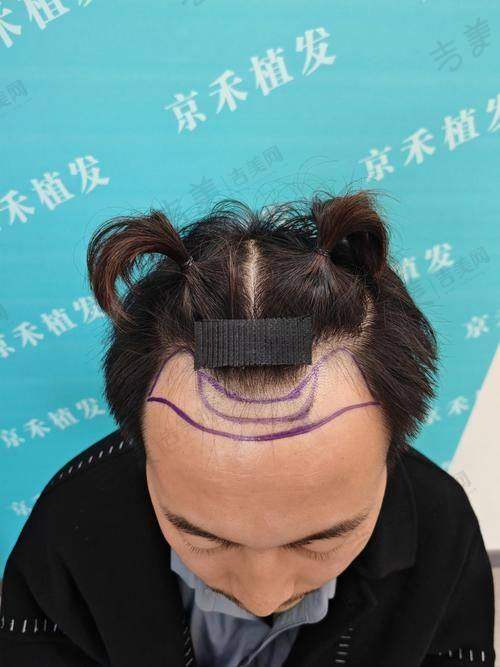 南宁星范整形医院口碑好不好？附真实患者口碑评价