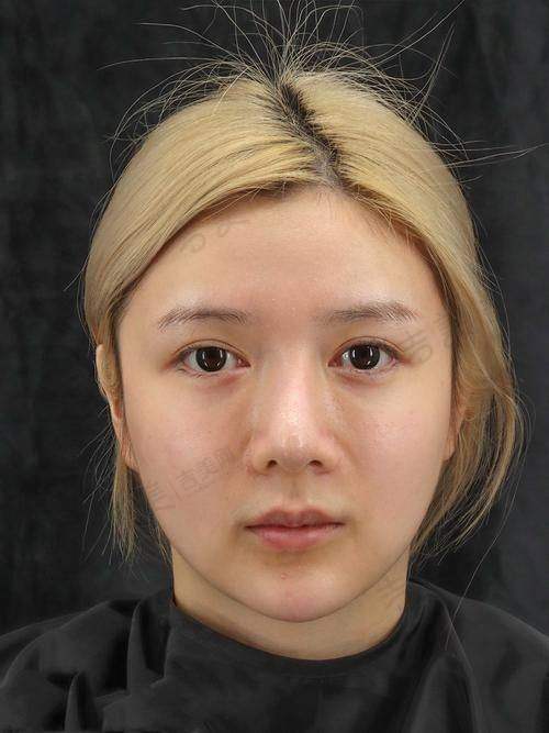 梁青松医生顾客实例图片