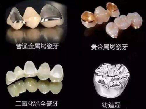 滁州天长天康医院鼎植口腔科口碑好不好?附真实患者口碑评价