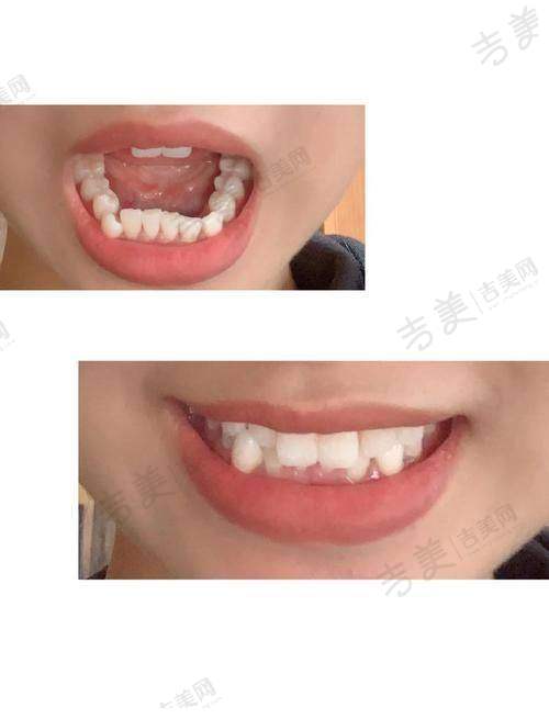 三、惠州鼎植永博口腔门诊部的具体地址在哪