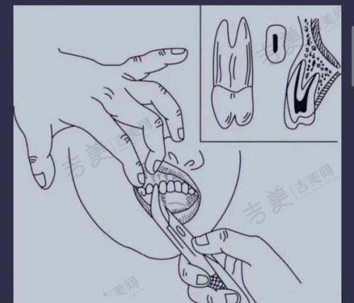 七、亳州兴化医院鼎植口腔科口碑好不好?附真实患者口碑评价