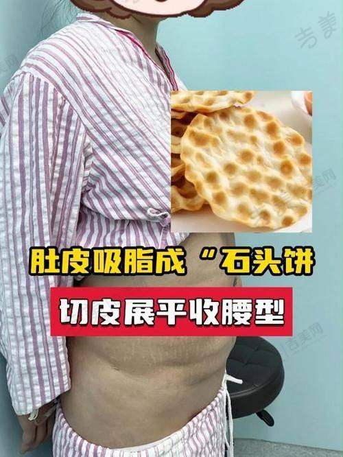 成都吸脂医生排名——成都八大处医疗美容医院唐勇、齐越