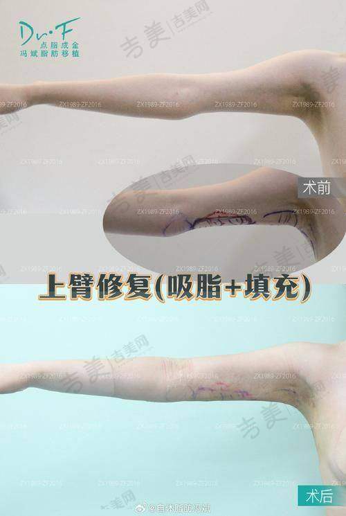 成都吸脂医生排名——成都友谊医院整形美容中 心马懿