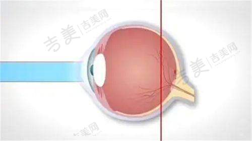 爱尔眼科各地医院地址查询