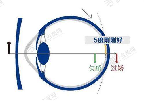 武汉大学人民医院眼科中 心特色呈现