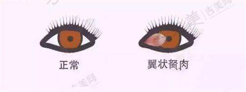 爱尔眼科综合优势总结与建议