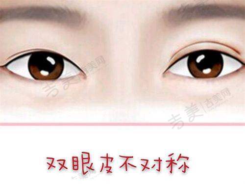 广州碧莲盛植发纹眉成活率高的优势展现