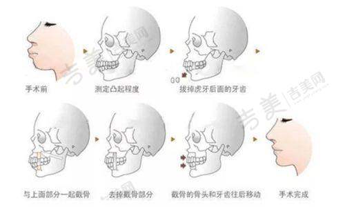 广州碧莲盛植发黄广程医生纹眉潜力分析