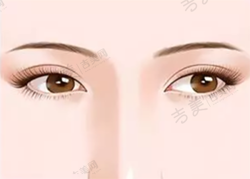 美佳医美医院脸部拉皮手术医生团队实力