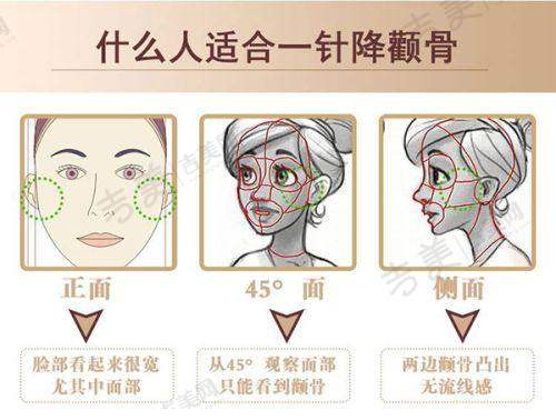 哈尔滨双燕整形双眼皮修复优势揭秘