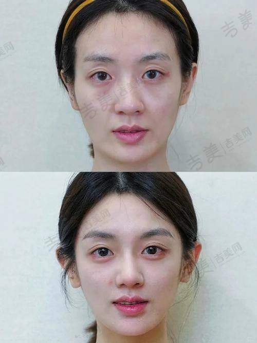 深圳安美聚光医疗美容门诊部的专精医生团队