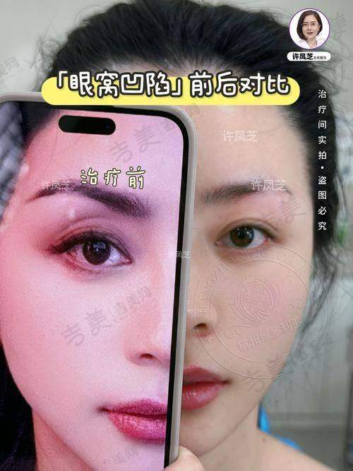 深圳安美聚光医疗美容门诊部的真实口碑反馈