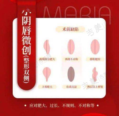 深圳做私处整形好的医院及收费价格一览之医院特色