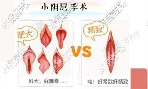 深圳做私处整形好的医院及收费价格一览之价格详情